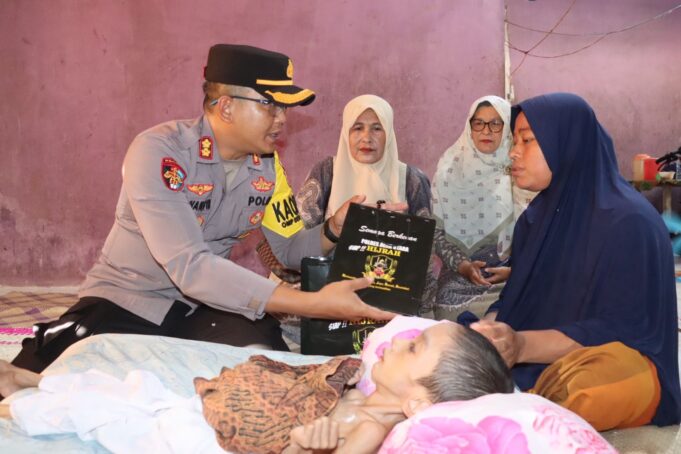 Sebagai Pilar Sosial Terdepan: Kapolres Aceh Utara Bantu Anak Kurang Gizi
