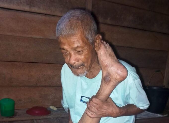 Aceh Utara: Kisah Pilu Abdurrahman, Kakek 75 Tahun yang Tinggal di Gubuk Derita