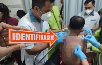 Polisi Buru Pelaku Penyiraman Air Keras terhadap Ibu dan Anak
