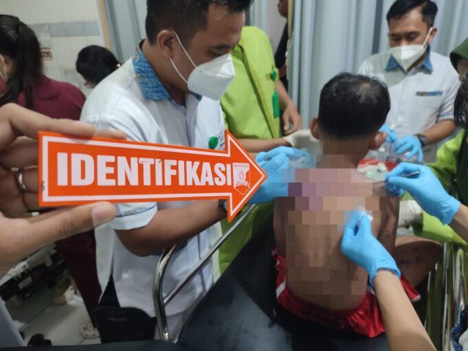 Polisi Buru Pelaku Penyiraman Air Keras terhadap Ibu dan Anak