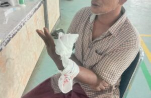 Miris, Pria Luka Parah Terpaksa Dibawa ke RS dengan Motor karena Sopir Ambulans Tak Kunjung Datang